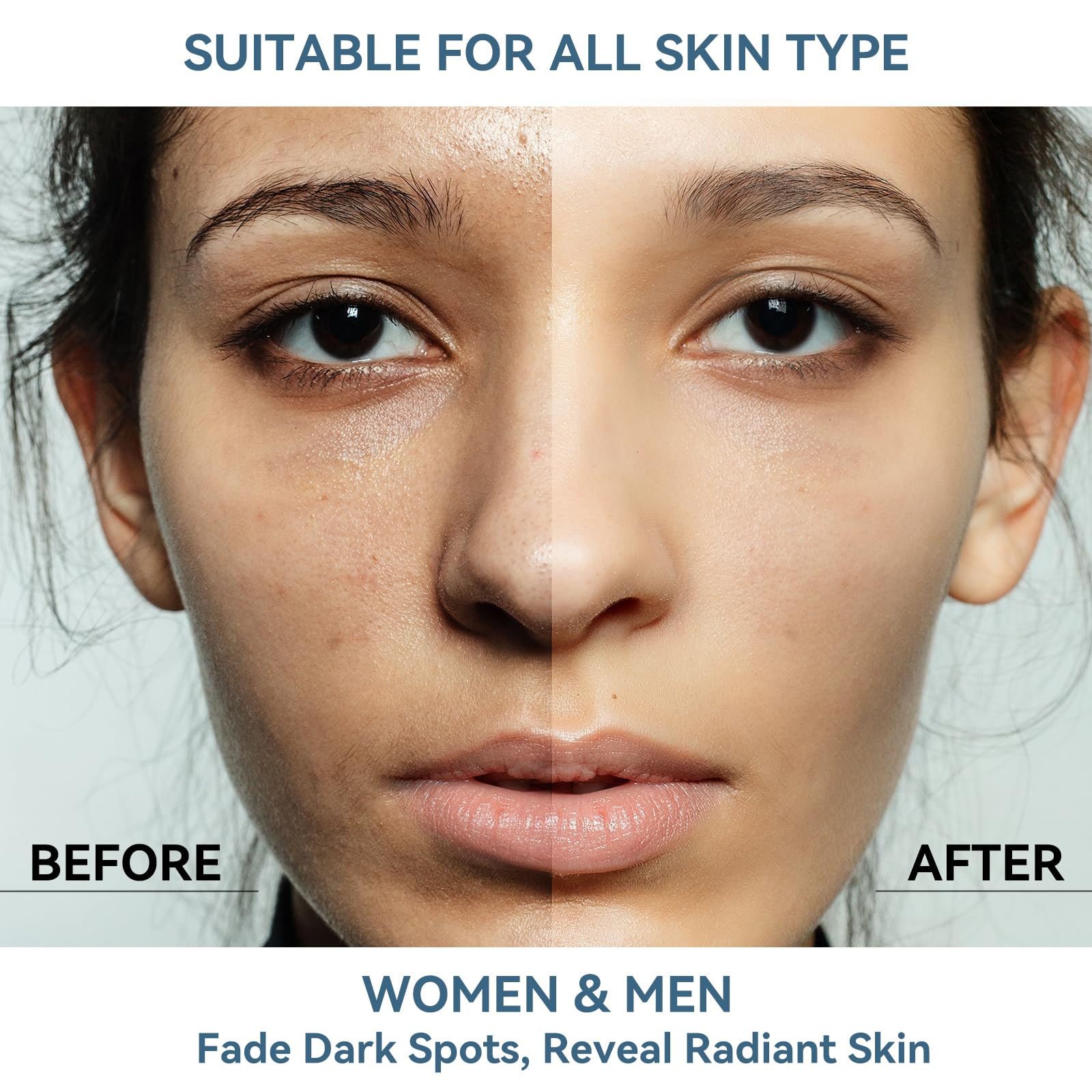 Dark Spot Remover for Face and Body, Dark Spot Corrector Serum, Melasma Treatment for face, Age Spot & Freckles Remover, Skin Care Serum for Uneven Skin Tone with 360° Roller Massage Ball, 0.67 fl. oz